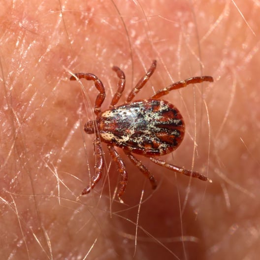 Lyme Disease Versus Rocky Mountain Spotted Fever